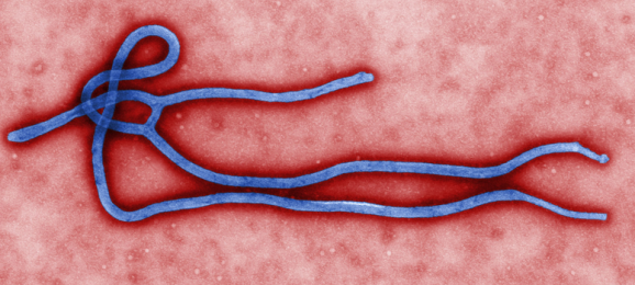 ebola virus